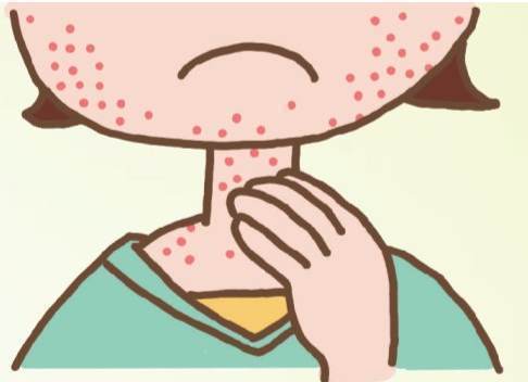 宝宝湿疹是什么原因造成的 去除湿疹的新希望：青蒿清肤霜（宝宝湿疹是母乳引起的吗）